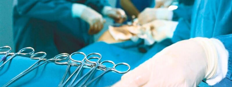 Varpos padidinimo operacija, kurią atlieka chirurgas