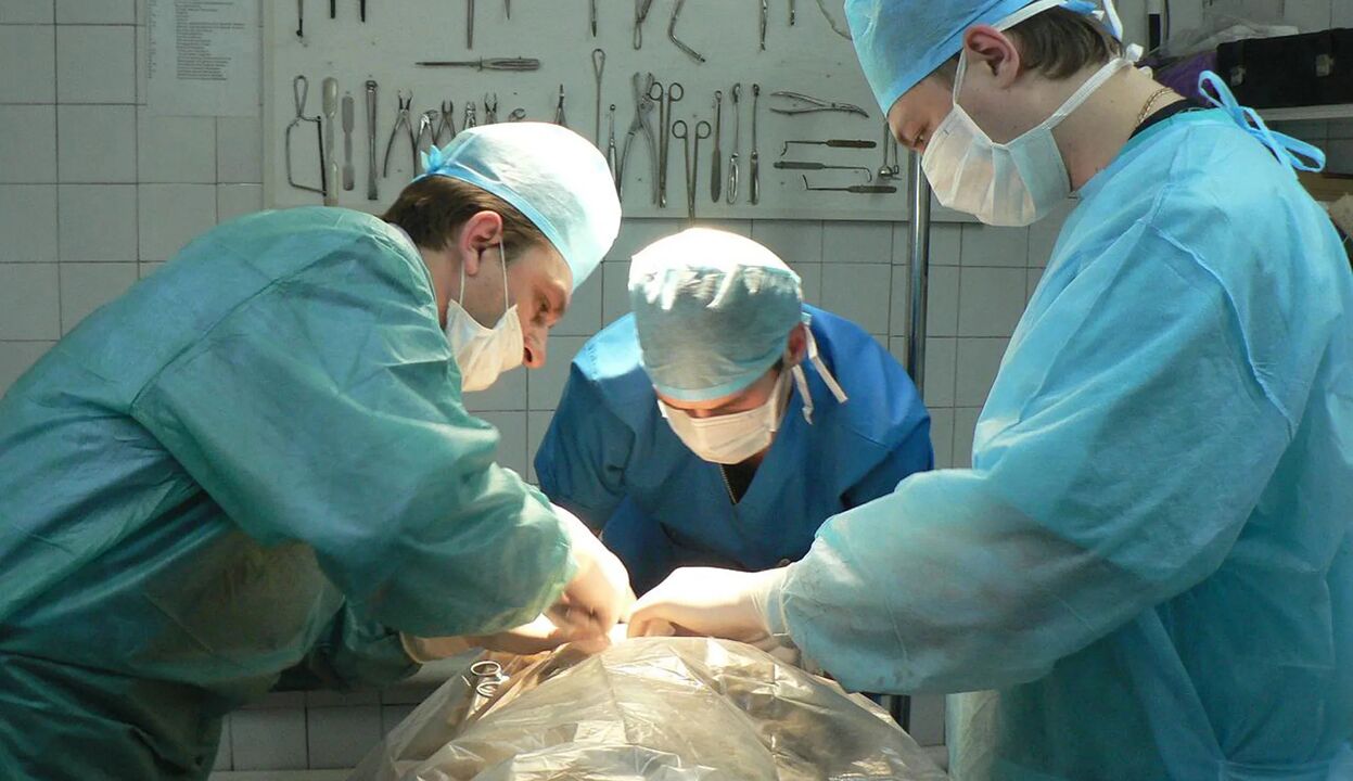Chirurgija yra brangus būdas padidinti varpą